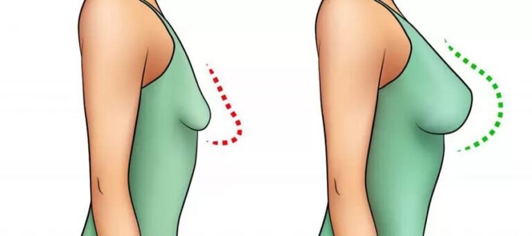 Breast Reduction Surgery