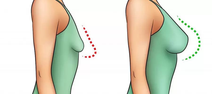 Breast Reduction Surgery